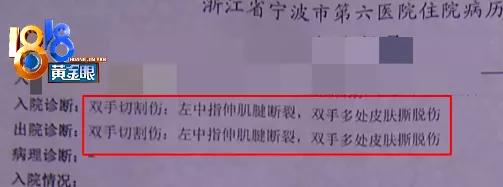 刷屏！被玻璃门割伤手的“小张”引来百万网友帮忙“维权”！